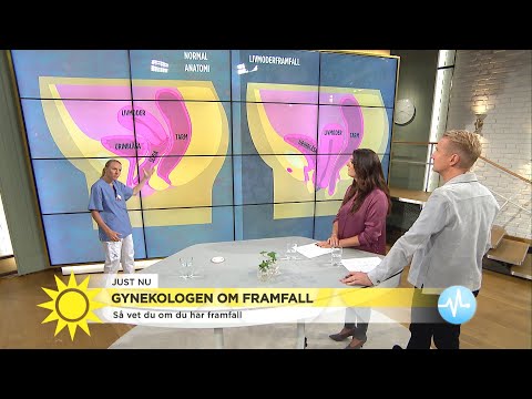 Video: Behandling Av Prolaps I Livmodern Hemma