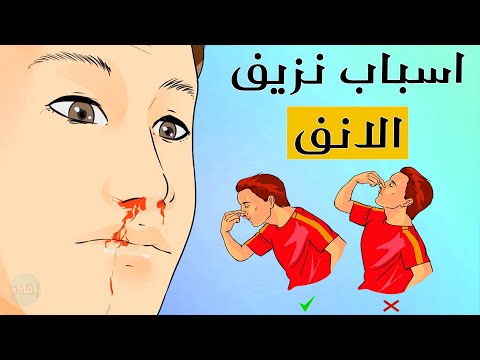 فيديو: 4 طرق لجعل أنفك تنزف دون أن تصاب بأذى