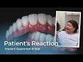 Patient Reaction to Permanent Dental Implant Bridge