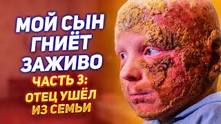 МОЙ СЫН ГНИЁТ ЗАЖИВО / ОТЕЦ УШЁЛ ИЗ СЕМЬИ / ЧЕШУЯ вместо кожи / Синдром KID, Ихтиоз