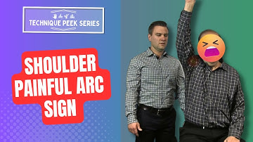 The Painful Arc Sign Test For Shoulder | Technique Peek Series