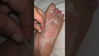 Foot Peel Mask | Foot Care Treatment | Foot Mask Results | Baby Soft Feet | Plantifique | shorts screenshot 1