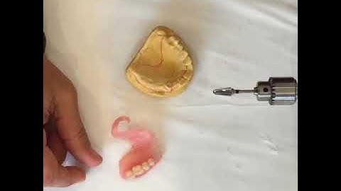 TCS Quick Tip 12 - Finishing A Flexible Partial Part 4