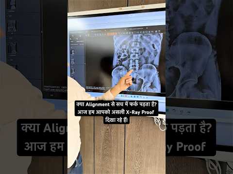 تم إصلاح القرص الانزلاقي في ثلاثة أشهر مقاوم للأشعة السينية