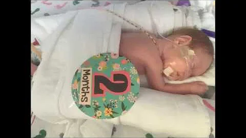 24 week micro preemie NICU journey