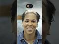 1 YEAR HAIR TRANSPLANT RESULTS - AFRO FEMALE WITH CCCA TYPE HAIR LOSS #afrohairtransplant