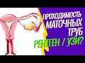 ГИСТЕРОСАЛЬПИНГОГРАФИЯ (ГСГ маточных труб) 🚩 Проверить проходимость труб