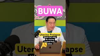 Buwa (Uterine Prolapse)