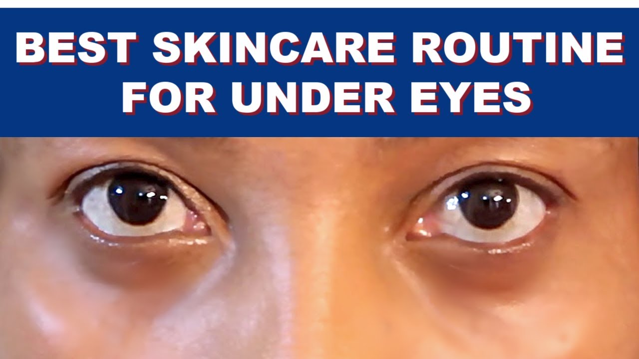 7 BEST REMEDIES FOR DARK CIRCLES PUFFY EYES AND EYE BAGS + BEST