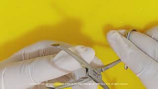 FusionKraft™ Allis Tissue Forceps, 6 (M-1735)