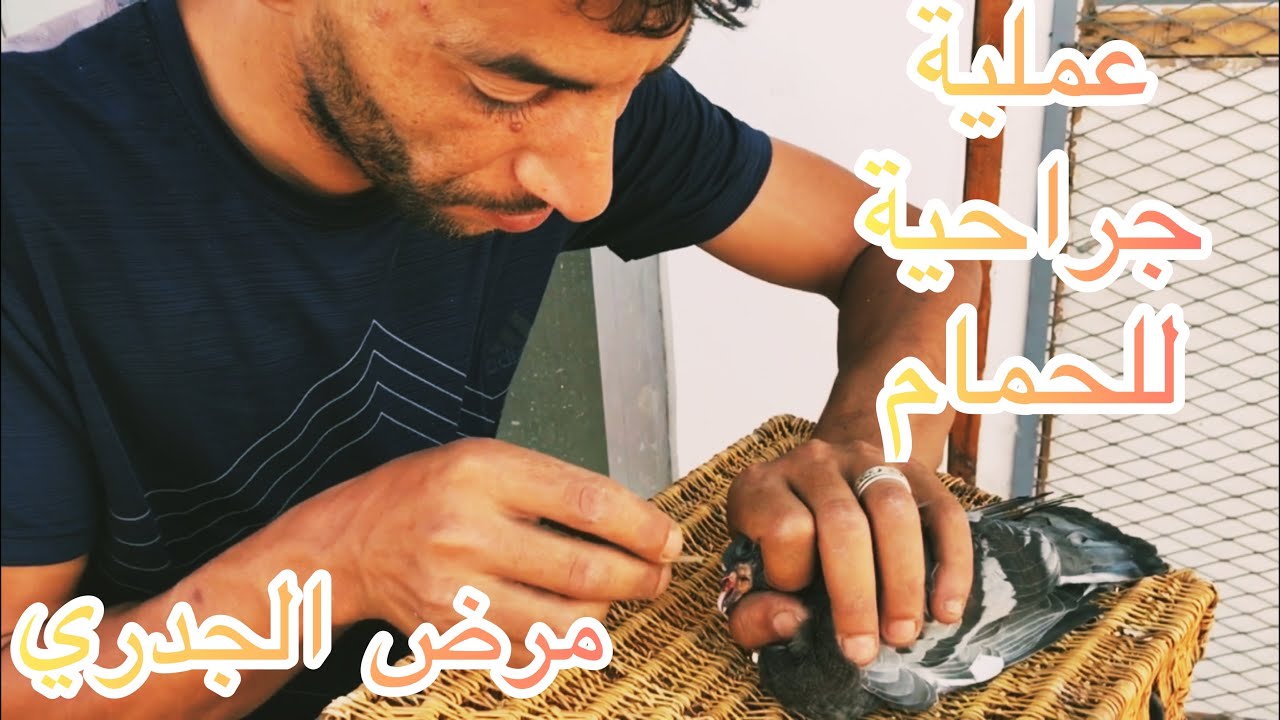 علاج جدري / علاج المرض نهائيا دقة بطلة من المرة الأولى/ أسهل طريقة بصوت والصورة 🔥