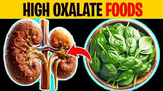 Avoid these 10 High Oxalate Foods if You have Kidney Disease