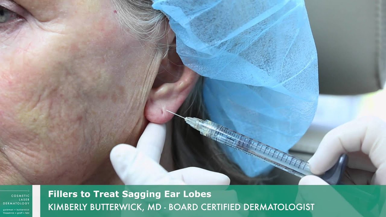 Banner for Earlobe Rejuvenation with Juvederm | Cosmetic Laser Dermatology