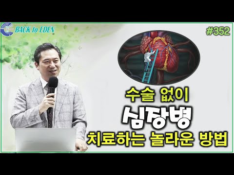 [천문천답] #352. 수술 없이 심장병 치료하는 놀라운 방법 [양일권 박사]