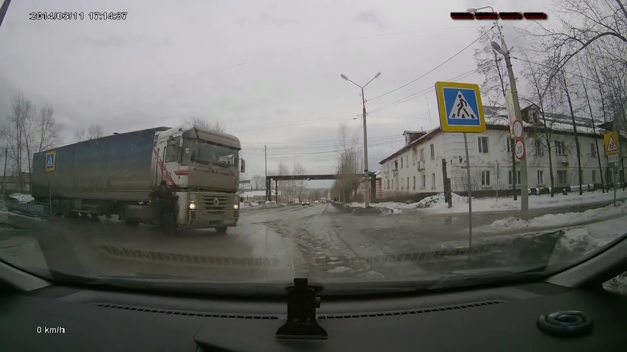 Нога раздавила машина Нога раздавила машина