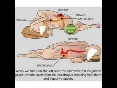 أنواع النوم