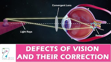 DEFECTS OF VISION AND THEIR CORRECTION