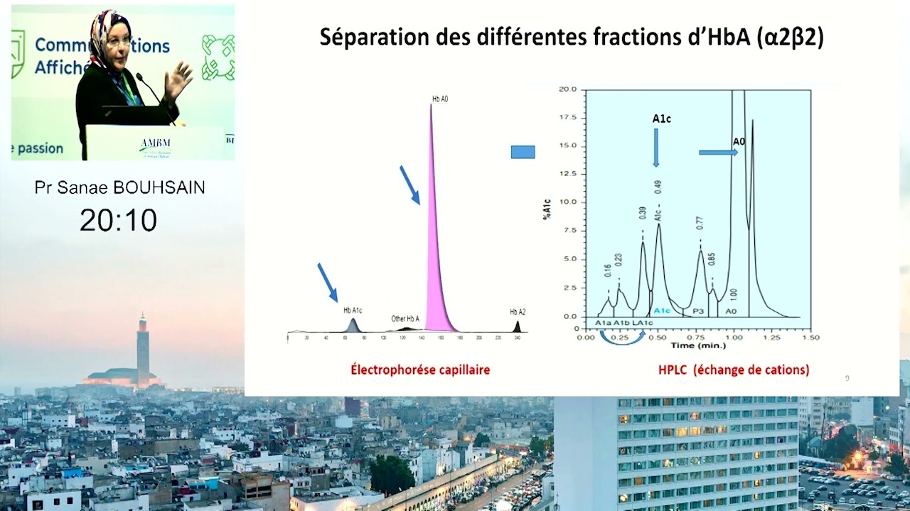 HbA1c  aspects analytiques et cliniques  Pr Sanae BOUHSAI