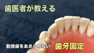 【横浜戸塚　内藤歯科】歯牙固定 動揺歯をあきらめない！