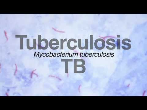 WHO Announces New Management of Latent TB Infection 1