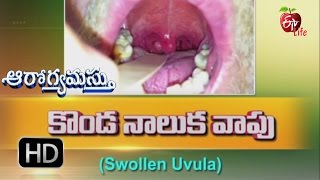 Aarogyamastu | Swollen Uvula | 6th January 2017 | ఆరోగ్యమస్తు screenshot 3