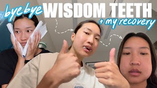 GETTING ALL MY WISDOM TEETH REMOVED *surgery recovery vlog* screenshot 3