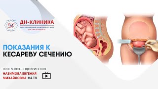 Лечение кольпита у женщин. Клиника Семейный доктор