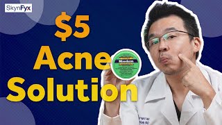 5 Acne Treatment Cheapest Way To Get Rid Of Acne