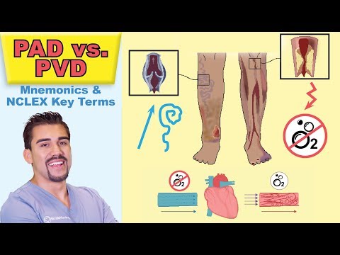 Pad Vs Pvd Chart