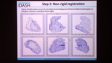 Segmentation and Analysis of Ventricles under Pulmonary Hypertension