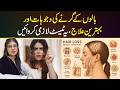 Hair Loss Treatment | Stop Hair Fall at Home | Hair Fall Causes &amp; Treatments | Girty Balon Ka ilaj
