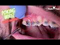 Braces Emergency - What to do if you have a Poking Wire - Tooth Time Family Dentistry New Braunfels