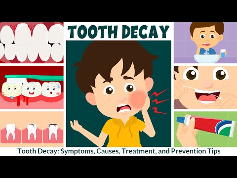 Wideo: Nowe wytyczne wydane w celu zapobiegania dzieciom młodym, jako trzem cierpiącym na próchnicę zębów
