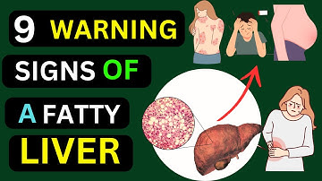 Unveiling the 9 warning signs of Fatty Liver you can