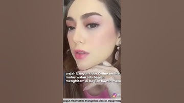 Wajah Celine Evangelista saat bangun tidur banjir pujian