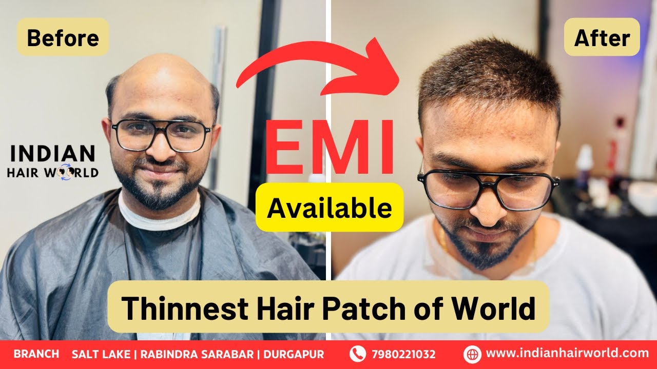 Discover the Thinnest Hair Patch in World | Hair Patch in Kolkata | Indian Hair World