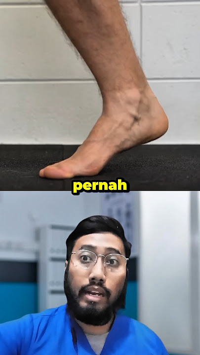 SIAPA YANG PERNAH ⁉️ Sakit di TELAPAK KAKI, mungkin plantar fasciitis #faktaunik #faktakesehatan