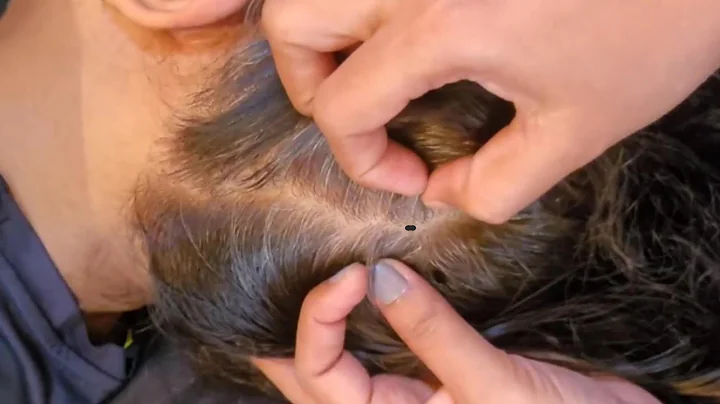 Scalp Check ASMR: The Ultimate Relaxation Experience