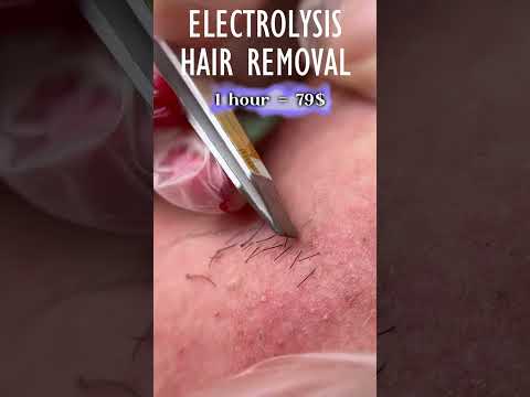 Aileen S Electrology