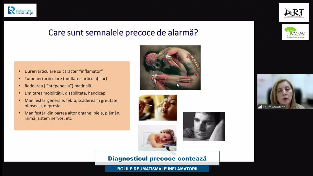 Importanta diagnosticului precoce în bolile reumatismale inflamatorii