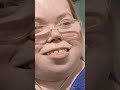 My rare #dwarfism is 1 in 200,000 ✨ #truly #borndifferent #selflove #bodyconfidence #ytshorts #short