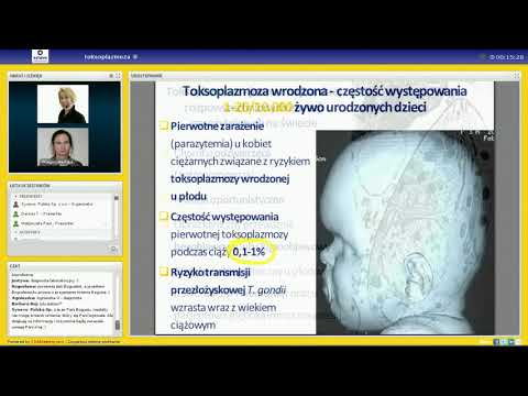 Webinar nt.  toksoplazmozy u kobiet ciężarnych i dzieci - 18/02/2013