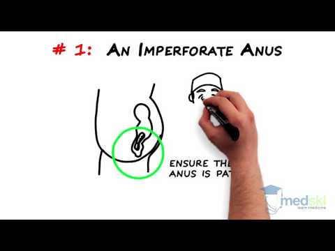 Video: Imperforate Anus: Symtom, Diagnos Och Behandlingar