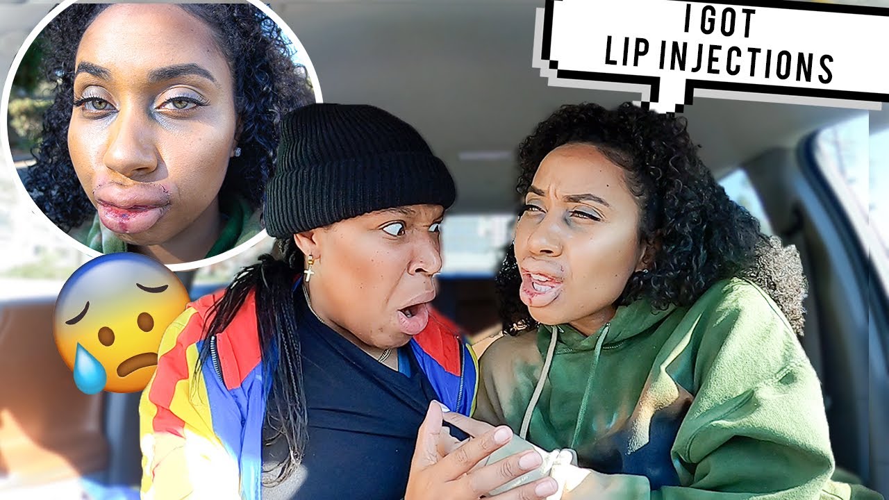 I got BOTOX without telling my girl friend & THIS HAPPENED..