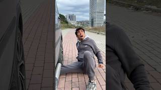 Bacağım Arabanın Altında Ezildi İzlerken Şaşıracaksınız