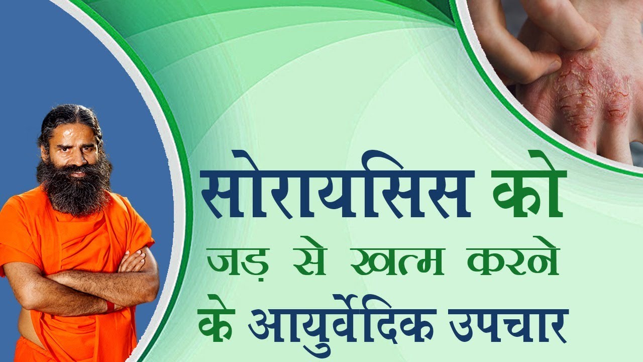 सोरायसिस को जड़ से खत्म करने के आयुर्वेदिक उपचार | Swami Ramdev