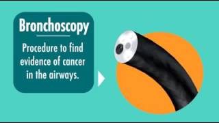CHEST Foundation Lung Cancer - How Can I Lessen My Symptoms?