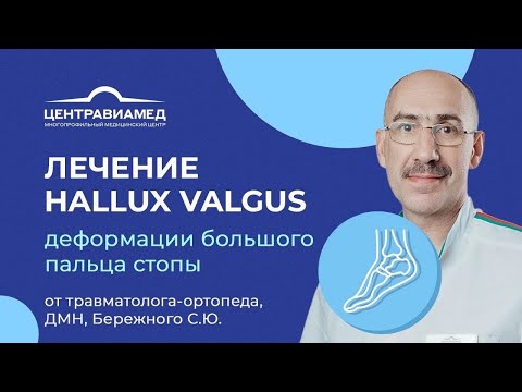 Операция вальгусной деформации большого пальца стопы