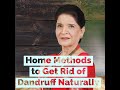  home methods to get rid of dandruff naturally  zubaida aapa   aasaan totkay 