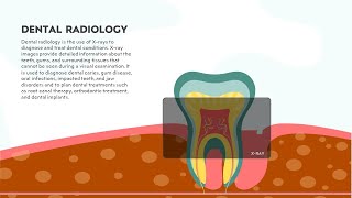 Dental Radiology Animated PPT Template